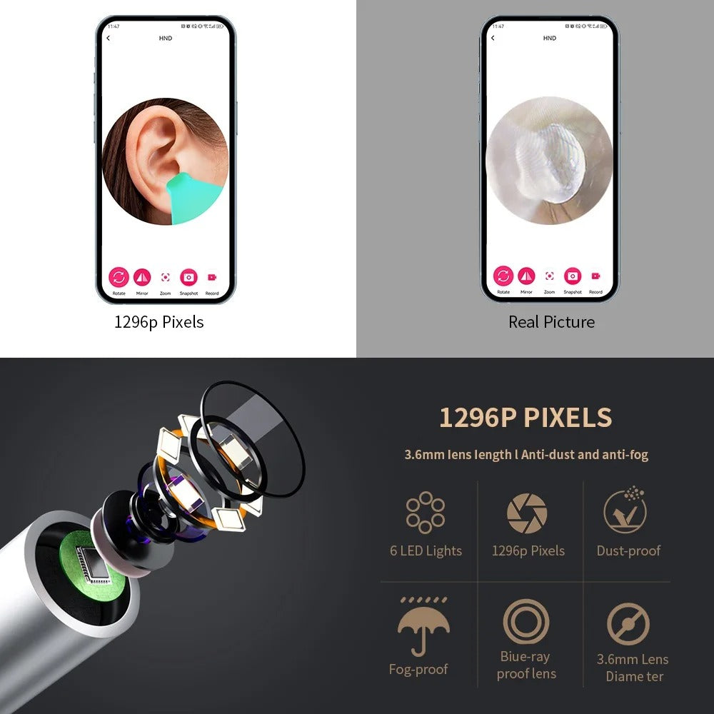 *Smart Visual Ear Cleaner with USB-C Charging*